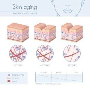 Skin Aging Chart
